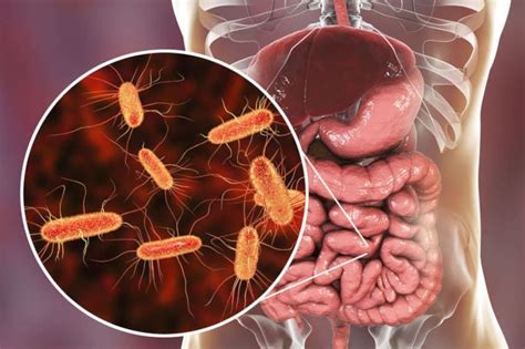 Virus Intestinale Di Cosa Si Tratta Quali Sono I Sintomi E Come Si Cura