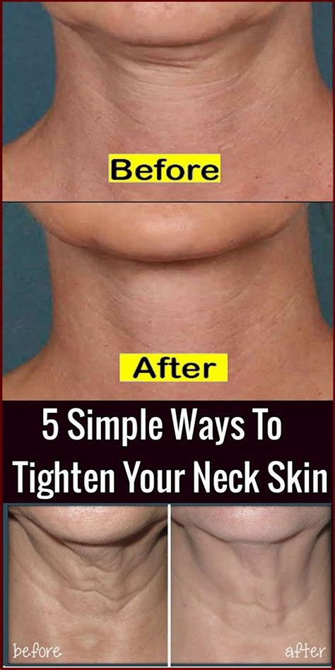 5 Simple Ways To Tighten Your Neck Skin Loose Neck Skin Tighten Neck