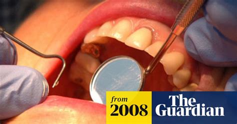 Dentists Overcharge Patients Via Contract Loophole Health The Guardian