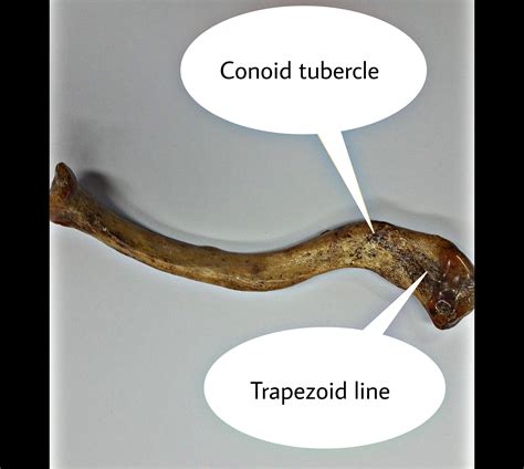 Conoid Tubercle