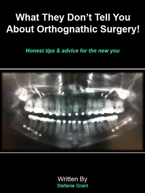 A Guide To Surviving Orthognathic Surgery March 2014