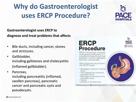Ppt Ercp Procedure Endoscopic Retrograde Cholangiopancreatography