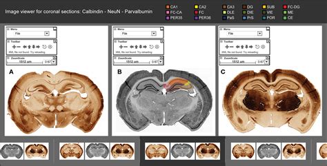 The scalable brain atlas does not own any of its templates. Proteine Atlas Rat / Dkk1 Gene Genecards Dkk1 Protein Dkk1 ...