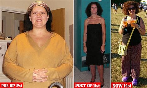 Woman Who Had £15k Nhs Funded Gastric Bypass Op Is Now Obese Again