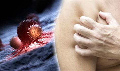 Blood Cancer Itchy Skin With No Rash Could Be A Warning Sign Of Your