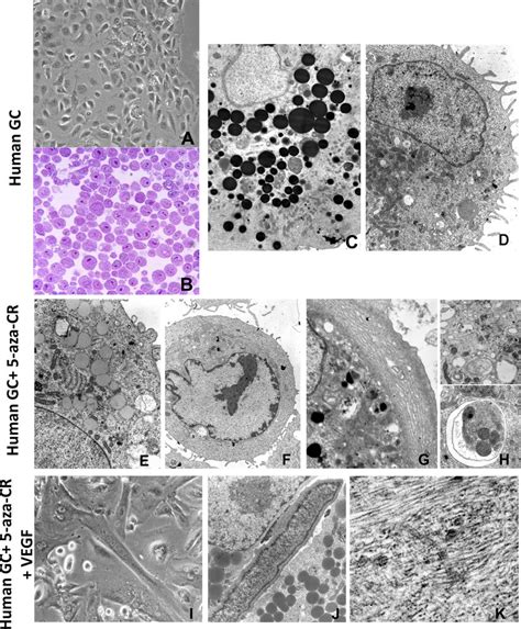 Morphological Changes Of Human Granulosa Cells Exposed To 5azacytidine