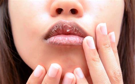 How To Cure Chapped Lips Once And For All During Colder Months