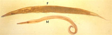 Enterobius Vermicularis Pinworm The Adult Worms Reside Within The Colon Of Their Human Hosts