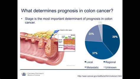 Colon And Rectal Cancer How Much Of A Problem Is It Really YouTube