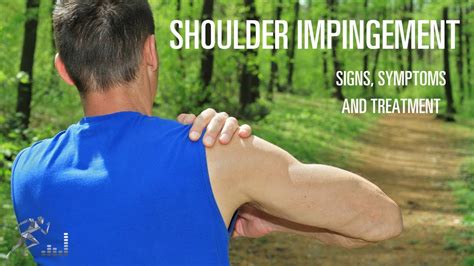 Shoulder Impingement Signs Symptoms And Treatment Youtube