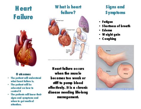 how to educate patients on heart disease jelitaf