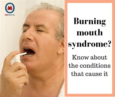 Burning Mouth Syndrome Symptoms Causes And Treatment