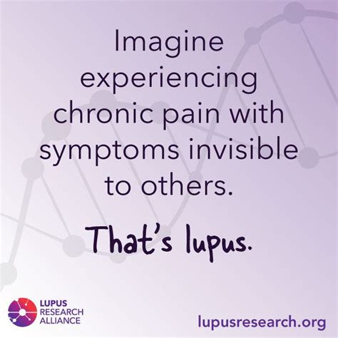 Pin On Lupus Infographics