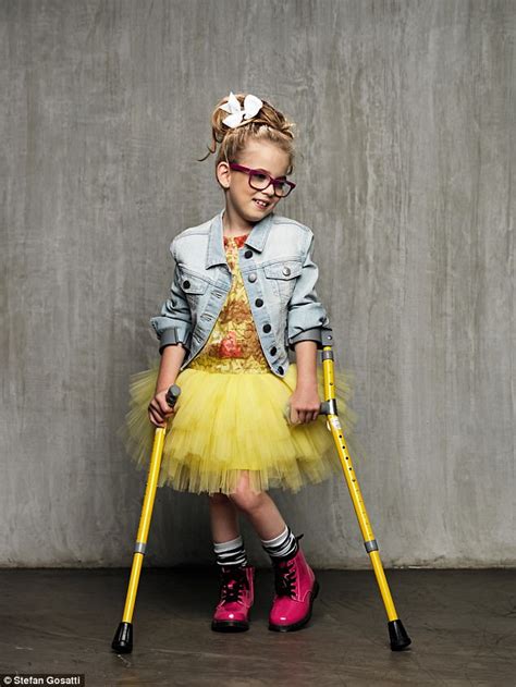 Model Emily Prior With Cerebral Palsy Opens Up On Career Daily Mail