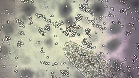 Paramecium Caudatum Under Microscope 100x Micropedia