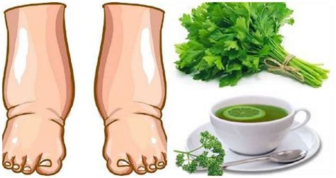 Este potente té casero te curara los pies hinchados en pocos días