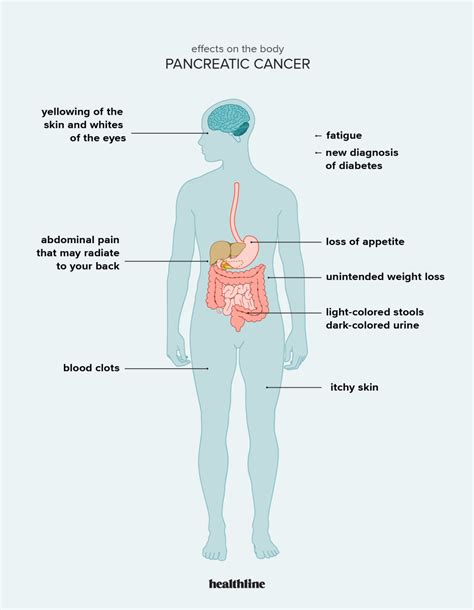 Pancreatic Cancer Symptoms In Men