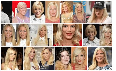 Tori Spelling Plastic Surgery Before And After American Actress