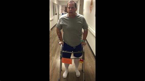 Amazing Change After Bilateral Direct Superior Total Hip Replacement By