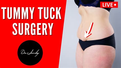 Dr Jeneby Tummy Tuck Surgery Abdominoplasty Transformation Youtube