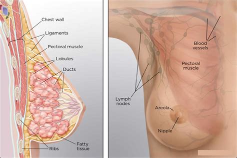 Help doctors place a biopsy needle into abnormal tissue. Breast fat necrosis causes, symptoms, diagnosis, treatment ...