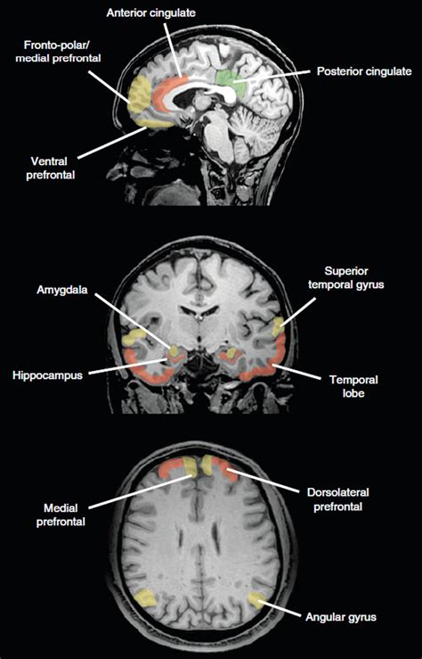 Brain Structures Hook Ap Psychology 4a