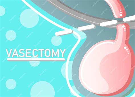 Premium Vector Cartoon Style Vasectomy Example Vector Illustration