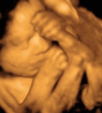 Her organs, tissues, and nerves continue to grow, but she. 3D Ultrasound Photos 28 Weeks - 32 Weeks | Baby ...