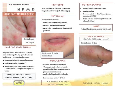 Brochure Hand Foot And Mouth Disease