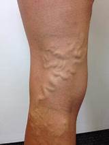 Doctor Who Specializes In Veins Images