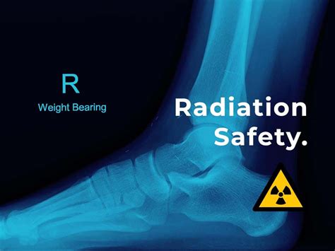 Ct Scan Radiation And X Ray Radiation Safety Guide