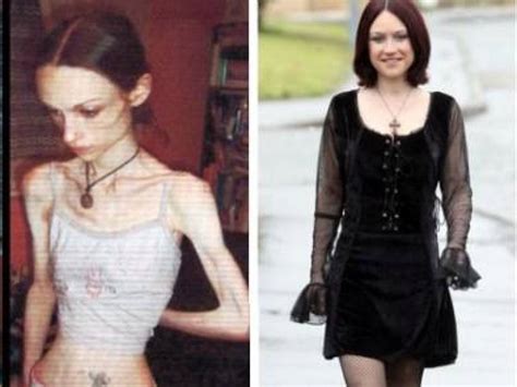 15 amazing girls who beat anorexia gallery ebaum s world