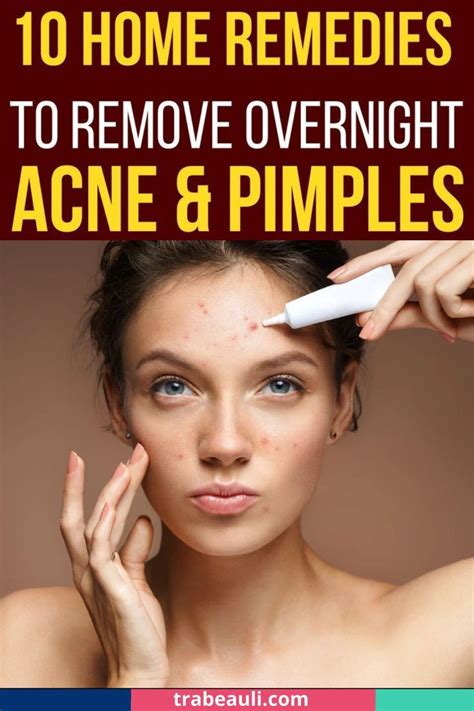 How To Get Rid Of Acne Overnight 6 Diys That Actually Work Artofit