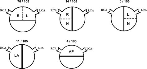 Variable Phenotypes Of Bicuspid Aortic Valve Disease