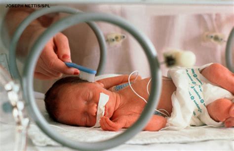 Outcomes In Extremely Preterm Us Infants Improve Study Finds The Bmj