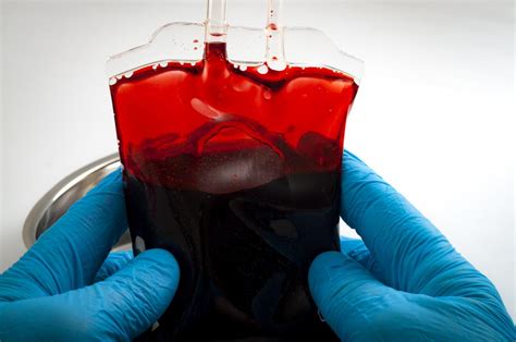 Trauma Death Risk Higher In People With Type O Blood