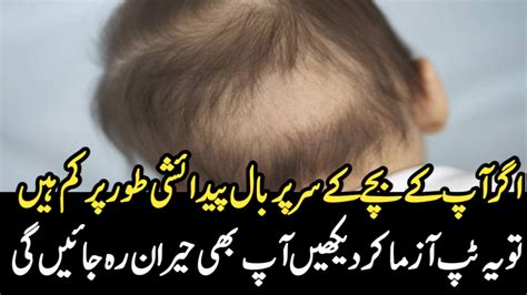اگر آپ کے بچے کے سر پر بال پیدائشی طور پر کم ہیں ۔۔ تو یہ ٹپ آزما کر دیکھیں آپ بھی حیران رہ