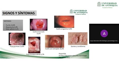 Tipos De Secreciones Vaginales Como Saber Si Es Anormal Images