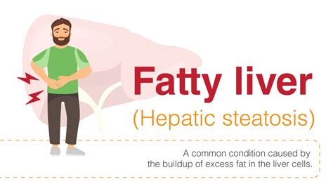 Fatty Liver Signs Symptoms And Diagnosis Webbypins