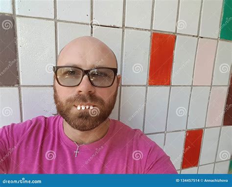 Bald Man In Eyeglasses With Ugly Teeth Stock Photo Image Of Lifestyle
