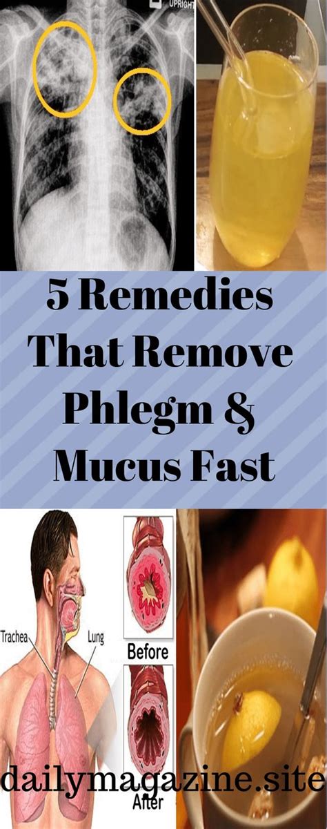 5 Remedies That Remove Phlegm And Mucus Fast Diy Craft Plus