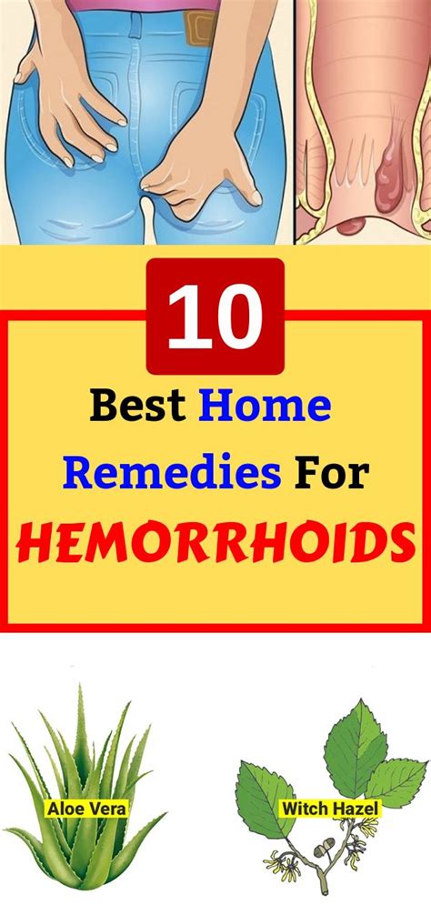 10 Best Home Remedies For Hemorrhoids Home Remedies For Hemorrhoids