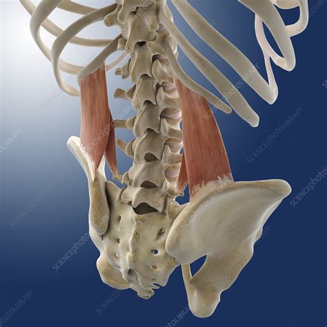 Pulled muscles, or strains, are common in the lower back because this area supports the weight of the upper body. Lower back muscles, artwork - Stock Image - C014/5015 - Science Photo Library