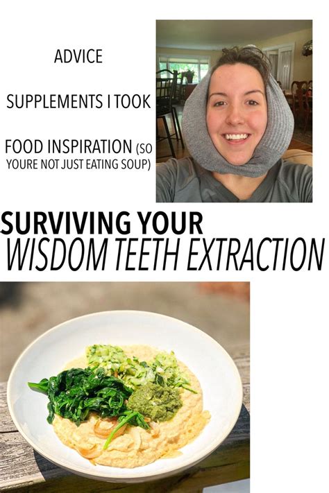 After my teeth were out for the first few days i could only eat really tiny things because it hurt to open just find a liquid that would go well with different solid foods (tomato soup with pizza. Surviving Your Wisdom Teeth Extraction | Wisdom teeth food ...