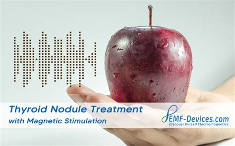 Thyroid Nodule Treatment With Pemf Therapy