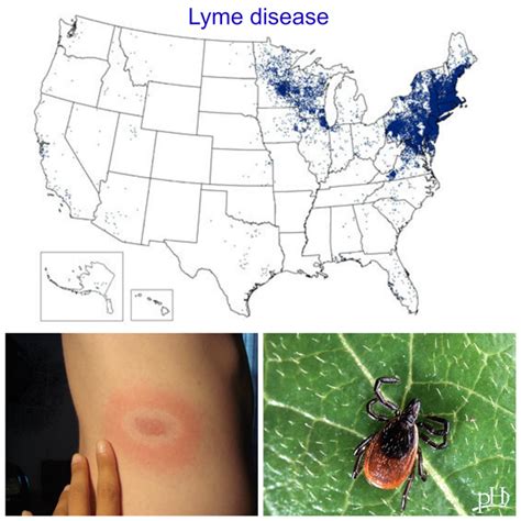 Lyme Disease A Small Tick Bite Can Cause Big Problems