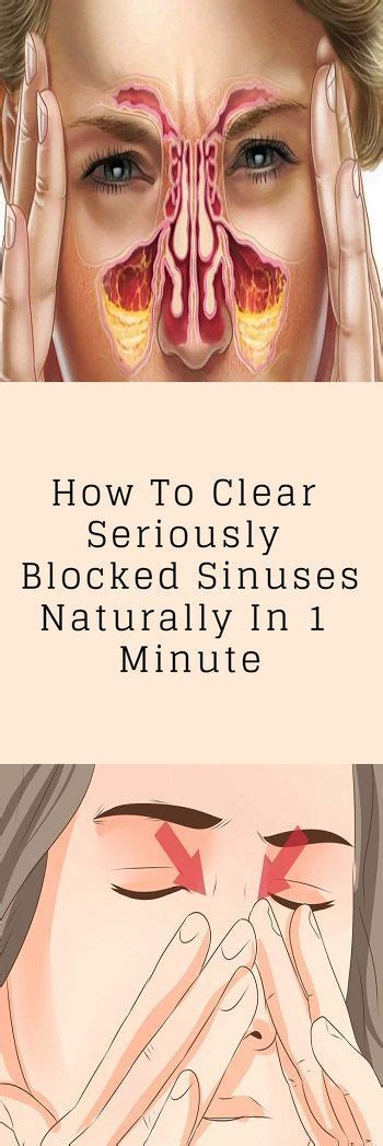 How To Clear Seriously Blocked Sinuses Naturally Blocked Sinuses