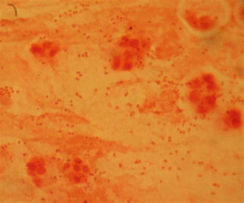 Habitat, cell morphology, cultural characteristic, biochemical tests influenzae will show satellitism. File:Haemophilus influenzae Gram.JPG - Wikimedia Commons