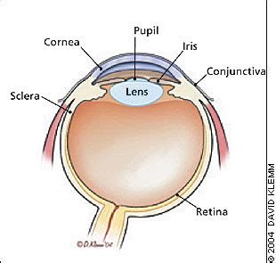 Management Of Corneal Abrasions
