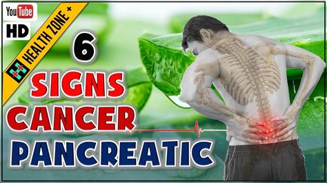 Cancer can also prevent the pancreas from. 6 Warning Signs and Symptoms of Pancreatic Cancer, No 5 is ...